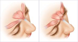 Vivella Med Spa | Orange, CA | vivellamedspa.com