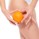 Cellulite Treatment
